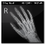 US Articular